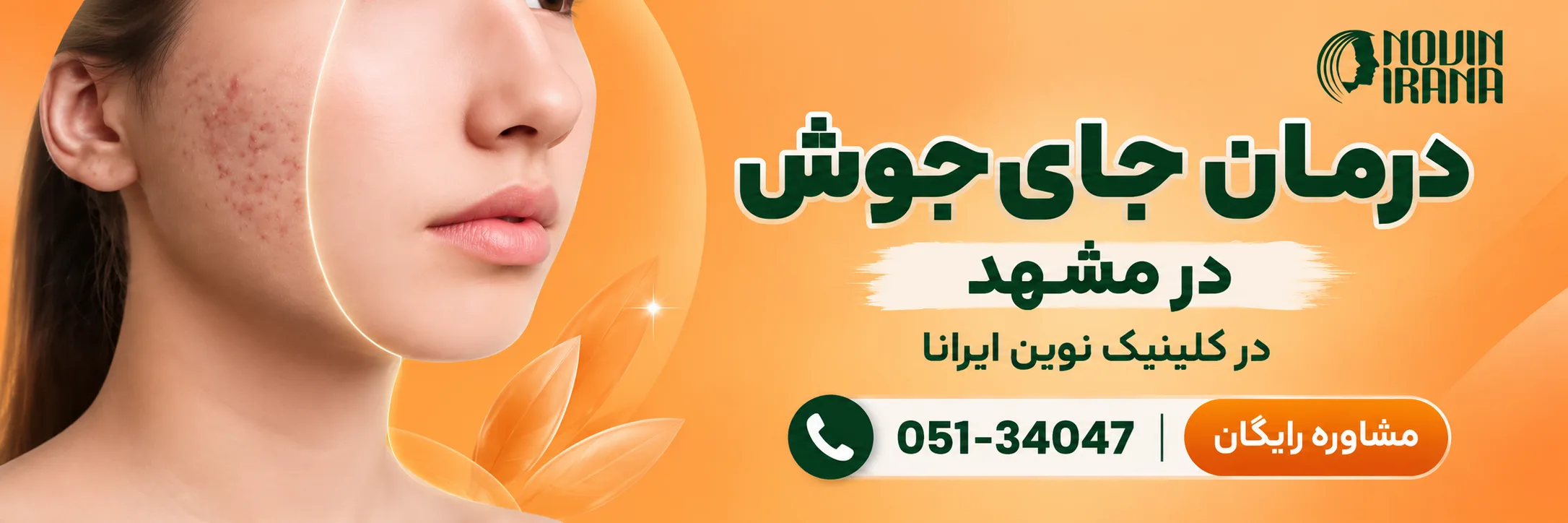 درمان جای جوش در کلینیک نوین ایرانا